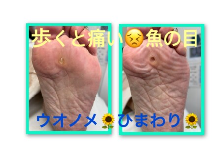 名古屋市瑞穂区豊岡通2-42-2　小林ビル1F 足の相談窓口 052-217-1122 無料カウンセリングを行っていますので、お気軽にお問合せください。 地下鉄桜通線　瑞穂運動場西下車　４番出口　徒歩1分