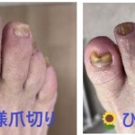 名古屋市瑞穂区豊岡通2-42-2　小林ビル1F 足の相談窓口 052-217-1122 無料カウンセリングを行っていますので、お気軽にお問合せください。 地下鉄桜通線　瑞穂運動場西下車　４番出口　徒歩1分