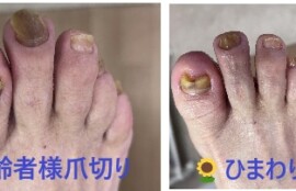 名古屋市瑞穂区豊岡通2-42-2　小林ビル1F 足の相談窓口 052-217-1122 無料カウンセリングを行っていますので、お気軽にお問合せください。 地下鉄桜通線　瑞穂運動場西下車　４番出口　徒歩1分