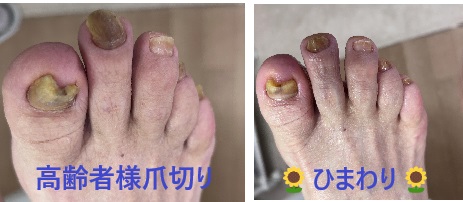 名古屋市瑞穂区豊岡通2-42-2　小林ビル1F 足の相談窓口 052-217-1122 無料カウンセリングを行っていますので、お気軽にお問合せください。 地下鉄桜通線　瑞穂運動場西下車　４番出口　徒歩1分