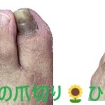名古屋市瑞穂区豊岡通2-42-2　小林ビル1F 足の相談窓口 052-217-1122 無料カウンセリングを行っていますので、お気軽にお問合せください。 地下鉄桜通線　瑞穂運動場西下車　４番出口　徒歩1分