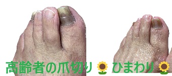 名古屋市瑞穂区豊岡通2-42-2　小林ビル1F 足の相談窓口 052-217-1122 無料カウンセリングを行っていますので、お気軽にお問合せください。 地下鉄桜通線　瑞穂運動場西下車　４番出口　徒歩1分