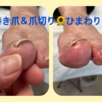 名古屋市瑞穂区豊岡通2-42-2　小林ビル1F 足の相談窓口 052-217-1122 無料カウンセリングを行っていますので、お気軽にお問合せください。 地下鉄桜通線　瑞穂運動場西下車　４番出口　徒歩1分