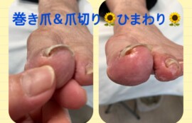 名古屋市瑞穂区豊岡通2-42-2　小林ビル1F 足の相談窓口 052-217-1122 無料カウンセリングを行っていますので、お気軽にお問合せください。 地下鉄桜通線　瑞穂運動場西下車　４番出口　徒歩1分