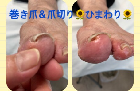 名古屋市瑞穂区豊岡通2-42-2　小林ビル1F 足の相談窓口 052-217-1122 無料カウンセリングを行っていますので、お気軽にお問合せください。 地下鉄桜通線　瑞穂運動場西下車　４番出口　徒歩1分