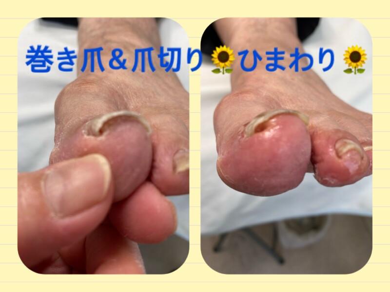 名古屋市瑞穂区豊岡通2-42-2　小林ビル1F 足の相談窓口 052-217-1122 無料カウンセリングを行っていますので、お気軽にお問合せください。 地下鉄桜通線　瑞穂運動場西下車　４番出口　徒歩1分