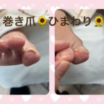 名古屋市瑞穂区豊岡通2-42-2　小林ビル1F 足のお悩み相談番号 （０５２）２１７－１１２２ 市営地下鉄桜通線　瑞穂運動場西下車　４番出口　徒歩１分 無料カウンセリングを行っていますので、お気軽にお問合せください。 当店では、巻き爪・タコ・魚の目・角質・爪切りなど、足に関するいろんなお悩みに対応しています♪
