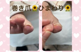 名古屋市瑞穂区豊岡通2-42-2　小林ビル1F 足のお悩み相談番号 （０５２）２１７－１１２２ 市営地下鉄桜通線　瑞穂運動場西下車　４番出口　徒歩１分 無料カウンセリングを行っていますので、お気軽にお問合せください。 当店では、巻き爪・タコ・魚の目・角質・爪切りなど、足に関するいろんなお悩みに対応しています♪