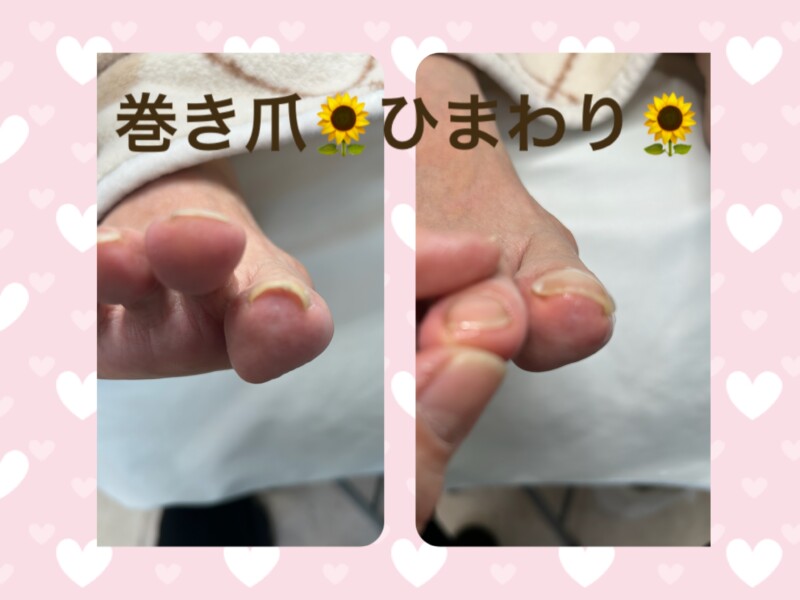 名古屋市瑞穂区豊岡通2-42-2　小林ビル1F 足のお悩み相談番号 （０５２）２１７－１１２２ 市営地下鉄桜通線　瑞穂運動場西下車　４番出口　徒歩１分 無料カウンセリングを行っていますので、お気軽にお問合せください。 当店では、巻き爪・タコ・魚の目・角質・爪切りなど、足に関するいろんなお悩みに対応しています♪
