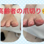 名古屋市瑞穂区豊岡通2-42-2　小林ビル1F 足のお悩み相談番号 （０５２）２１７－１１２２ 市営地下鉄桜通線　瑞穂運動場西下車　４番出口　徒歩１分 無料カウンセリングを行っていますので、お気軽にお問合せください。 当店では、巻き爪・タコ・魚の目・角質・爪切りなど、足に関するいろんなお悩みに対応しています♪