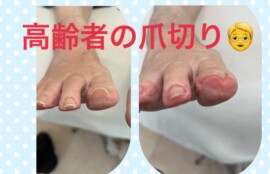 名古屋市瑞穂区豊岡通2-42-2　小林ビル1F 足のお悩み相談番号 （０５２）２１７－１１２２ 市営地下鉄桜通線　瑞穂運動場西下車　４番出口　徒歩１分 無料カウンセリングを行っていますので、お気軽にお問合せください。 当店では、巻き爪・タコ・魚の目・角質・爪切りなど、足に関するいろんなお悩みに対応しています♪
