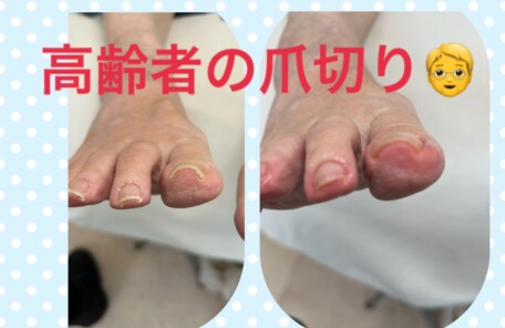 名古屋市瑞穂区豊岡通2-42-2　小林ビル1F 足のお悩み相談番号 （０５２）２１７－１１２２ 市営地下鉄桜通線　瑞穂運動場西下車　４番出口　徒歩１分 無料カウンセリングを行っていますので、お気軽にお問合せください。 当店では、巻き爪・タコ・魚の目・角質・爪切りなど、足に関するいろんなお悩みに対応しています♪