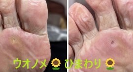 名古屋市瑞穂区豊岡通2-42-2　小林ビル1F 足の相談窓口 052-217-1122 無料カウンセリングを行っていますので、お気軽にお問合せください。 地下鉄桜通線　瑞穂運動場西下車　４番出口　徒歩1分