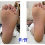 名古屋市瑞穂区豊岡通2-42-2　小林ビル1F 足の相談窓口 052-217-1122 無料カウンセリングを行っていますので、お気軽にお問合せください。 地下鉄桜通線　瑞穂運動場西下車　４番出口　徒歩1分