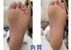 名古屋市瑞穂区豊岡通2-42-2　小林ビル1F 足の相談窓口 052-217-1122 無料カウンセリングを行っていますので、お気軽にお問合せください。 地下鉄桜通線　瑞穂運動場西下車　４番出口　徒歩1分