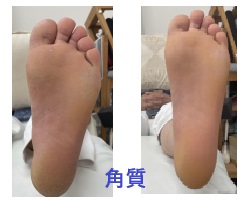名古屋市瑞穂区豊岡通2-42-2　小林ビル1F 足の相談窓口 052-217-1122 無料カウンセリングを行っていますので、お気軽にお問合せください。 地下鉄桜通線　瑞穂運動場西下車　４番出口　徒歩1分