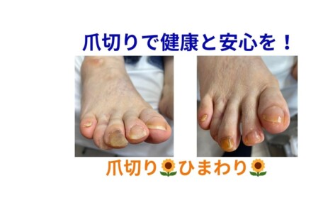 名古屋市瑞穂区豊岡通2-42-2　小林ビル1F 足のお悩み相談番号 （０５２）２１７－１１２２ 市営地下鉄桜通線　瑞穂運動場西下車　４番出口　徒歩１分 無料カウンセリングを行っていますので、お気軽にお問合せください。 当店では、巻き爪・タコ・魚の目・角質・爪切りなど、足に関するいろんなお悩みに対応しています♪