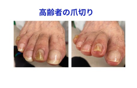 名古屋市瑞穂区豊岡通2-42-2　小林ビル1F 足のお悩み相談番号 （０５２）２１７－１１２２ 市営地下鉄桜通線　瑞穂運動場西下車　４番出口　徒歩１分 無料カウンセリングを行っていますので、お気軽にお問合せください。