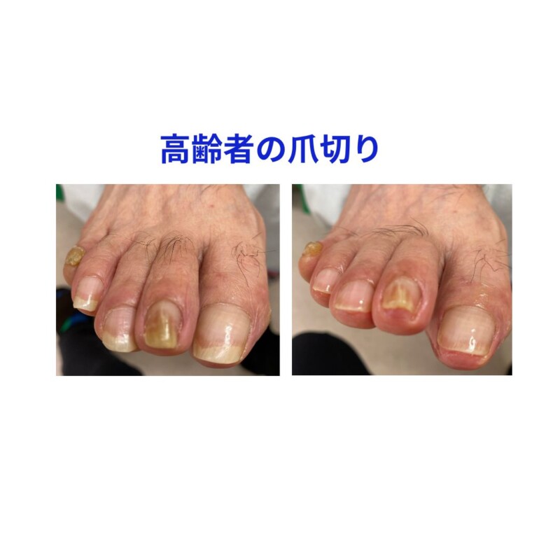 名古屋市瑞穂区豊岡通2-42-2　小林ビル1F 足のお悩み相談番号 （０５２）２１７－１１２２ 市営地下鉄桜通線　瑞穂運動場西下車　４番出口　徒歩１分 無料カウンセリングを行っていますので、お気軽にお問合せください。