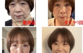 肌をつくりましょう！