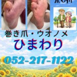 ご高齢車様爪切り、ウオノメ、タコ、角質、爪切り、フットケア