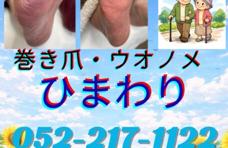 ご高齢車様爪切り、ウオノメ、タコ、角質、爪切り、フットケア