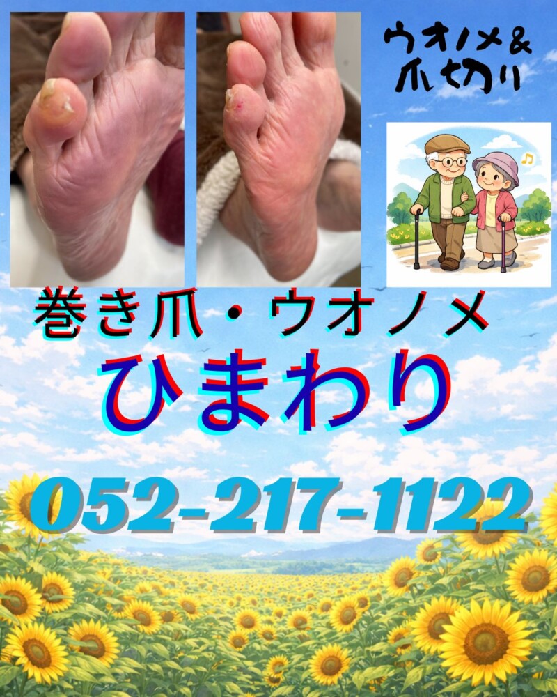 ご高齢車様爪切り、ウオノメ、タコ、角質、爪切り、フットケア