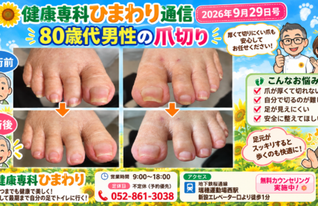 .爪切り、巻き爪、タコ、ウオノメ