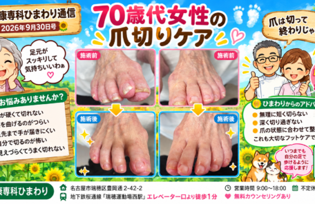 爪切り、爪切りケア、巻き爪、タコ、ウオノメ、角質