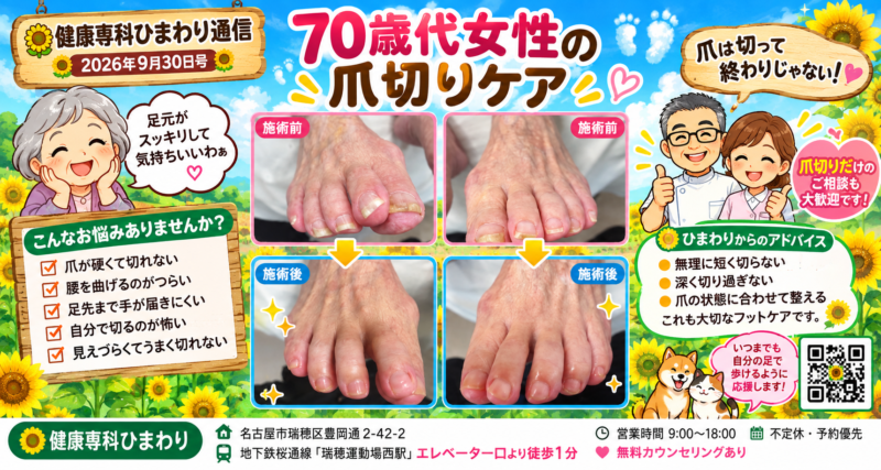爪切り、爪切りケア、巻き爪、タコ、ウオノメ、角質