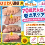 巻き爪、爪切り、タコ、ウオノメ、