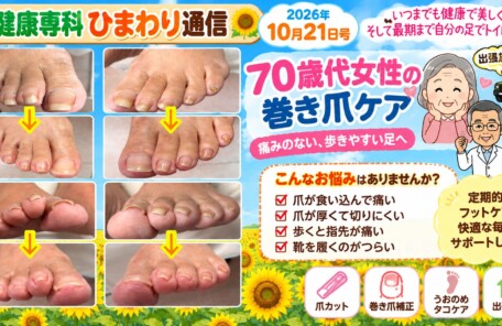 巻き爪、爪切り、タコ、ウオノメ、