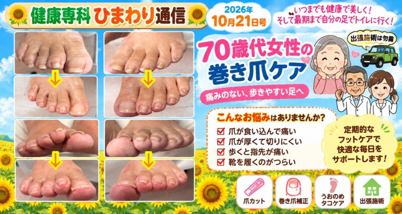 巻き爪、爪切り、タコ、ウオノメ、
