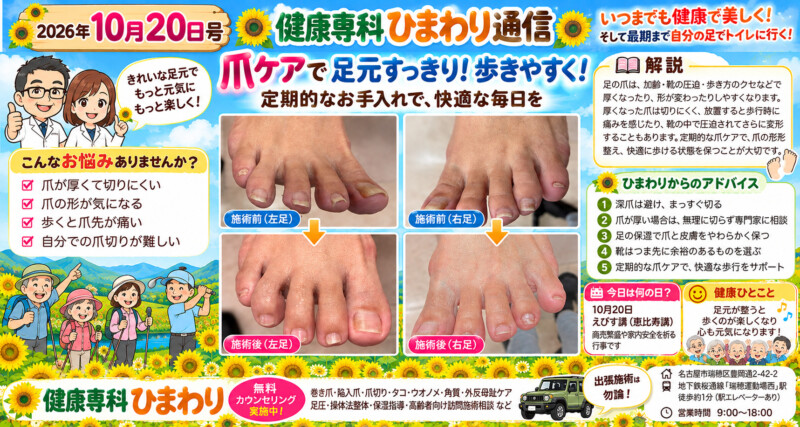 巻き爪、ウオノメ、タコ、爪切り、角質